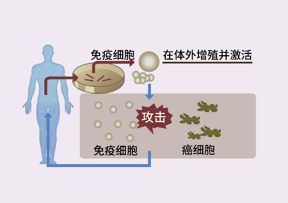 免疫細胞療法